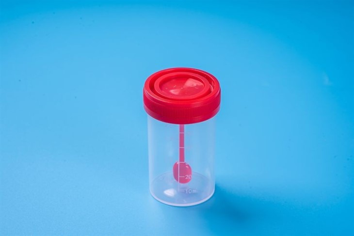 Medical 30ml 60ml 100ml Specimen Cup Urine Container For Urine Collection